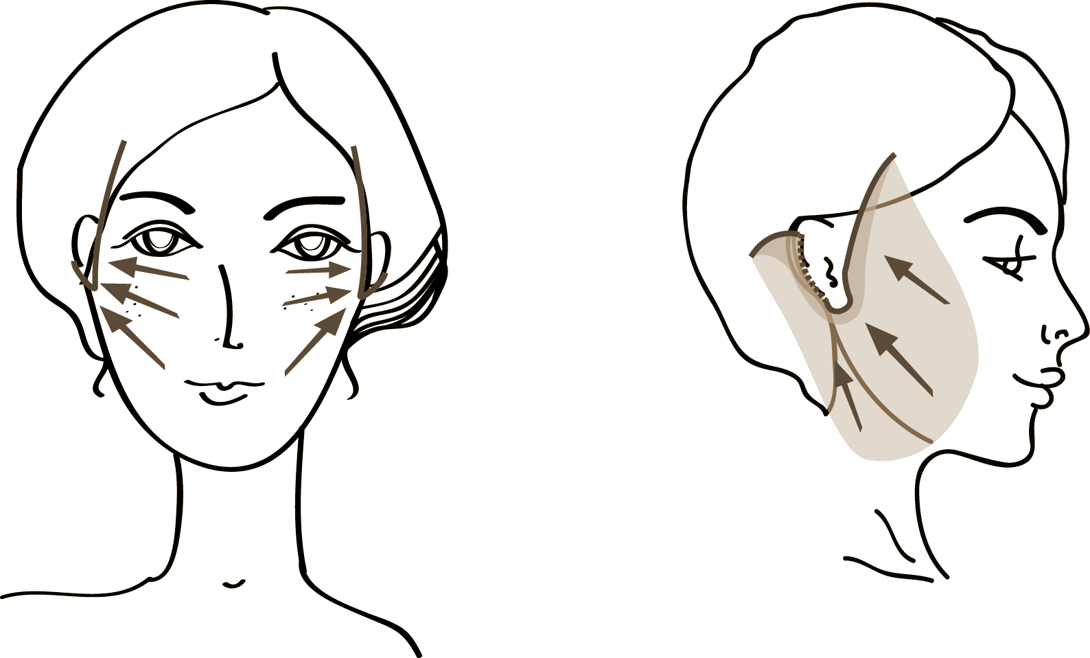 Facelift Rosenheim - Dr. med. Florian Sandweg